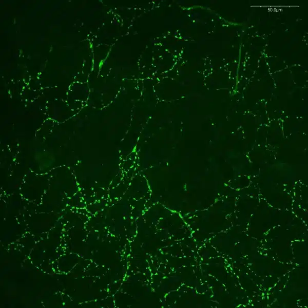 octopamine antibody rabbit polyclonal validated crayfish brain whole mount