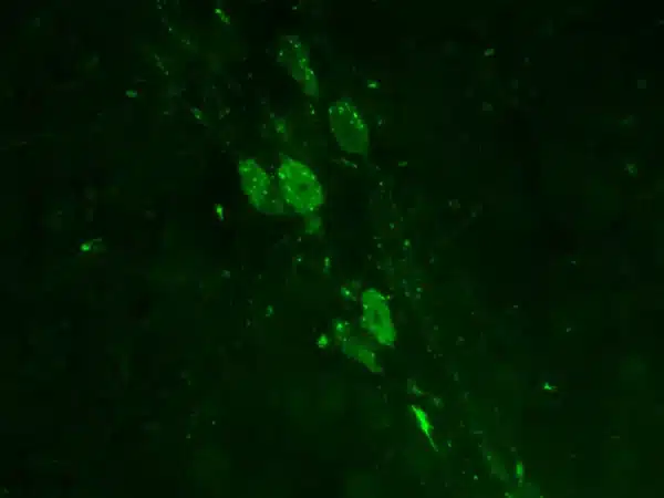 Immunostaining of 5-HT-containing cells in adult mouse brain slice