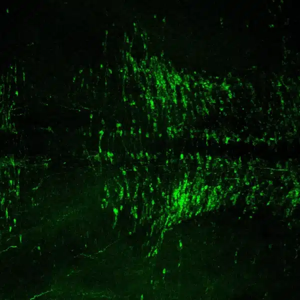 serotonin antibody 5-ht imaging staining kit