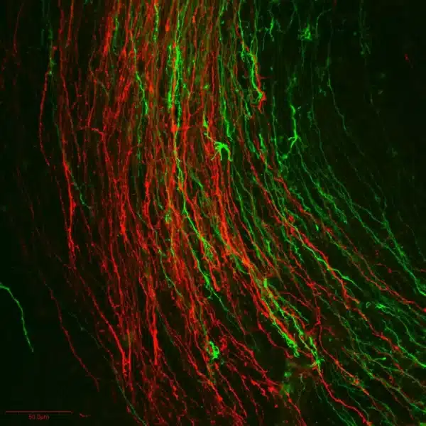 Dopamine (green) and Serotonin (red) immunostaining in the CNS of embryonic mouse E13.5