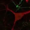 Dopamine (green) and Serotonin (red) immunostaining in mouse culture of primary midbrain neurons