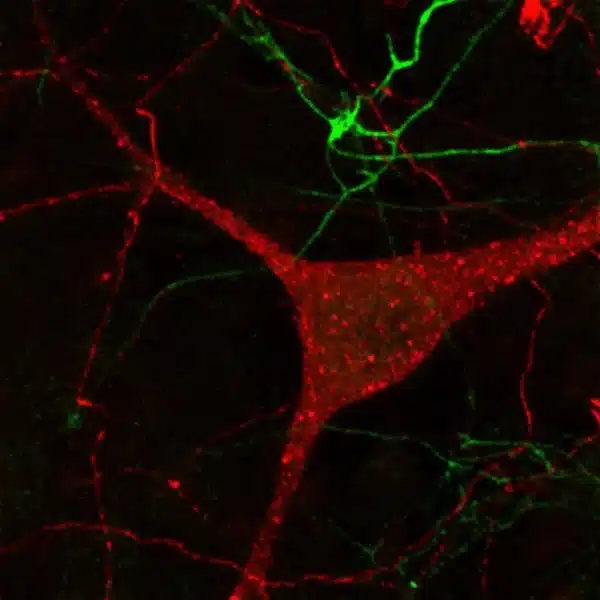 Dopamine (green) and Serotonin (red) immunostaining in mouse culture of primary midbrain neurons