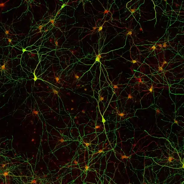staining kit gaba antibody ihc cell culture staining primary neurons