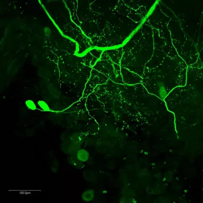 stainperfect staining dopamine antibody