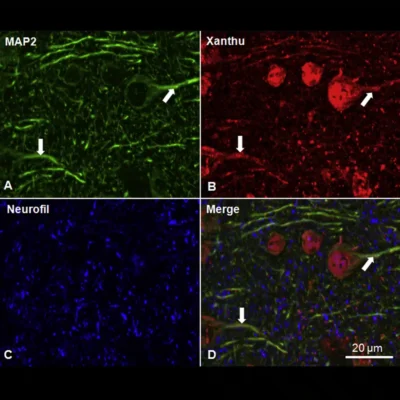 Xanthurenic acid in mouse brain tissue sections