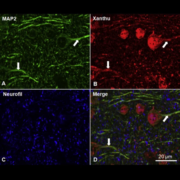 xanthurenic acid-antibody IF validation in mouse brain tissue imaging IF IHC