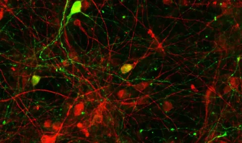 PICTURE OF THE WEEK: Serotonin in primary mesencephalic cells