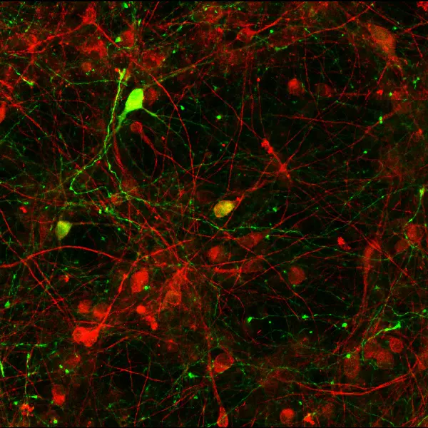 PICTURE OF THE WEEK: Serotonin in primary mesencephalic cells