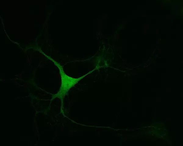 L.Phenyl-Alanine imaging in mouse embryonic midbrain neurons