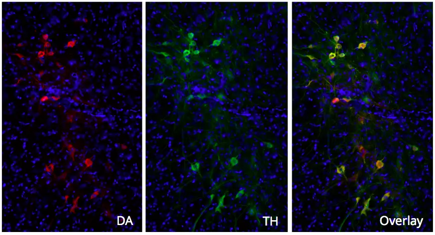 Take the opportunity of a special offer to try our Dopamine Ab