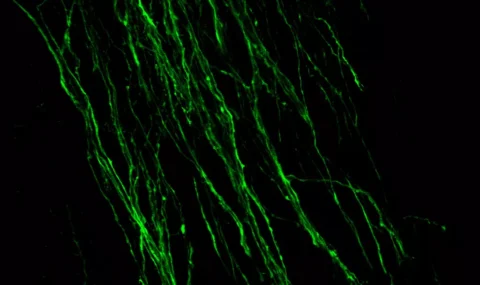 PICTURE OF THE WEEK: Dopamine staining in embryonic mouse brain