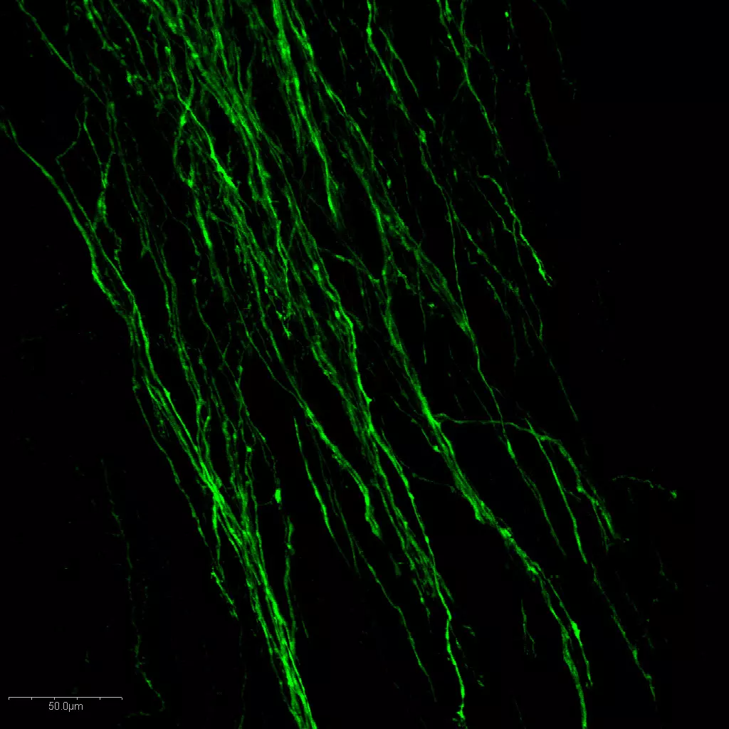 PICTURE OF THE WEEK: Dopamine staining in embryonic mouse brain