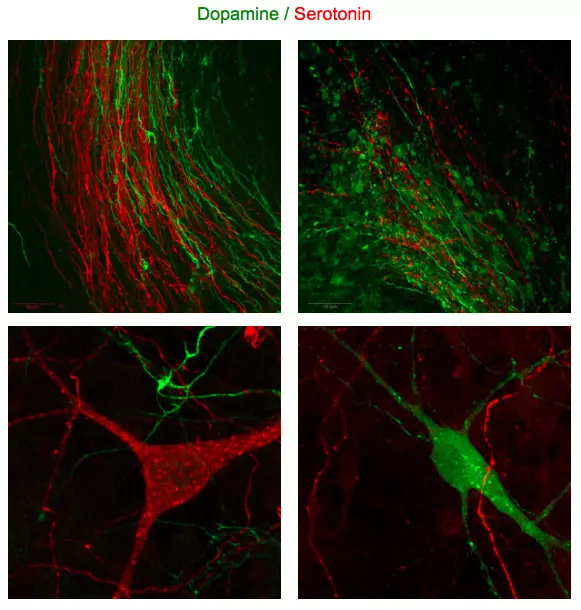 Get access to the Dopamine and Serotonin crosstalk using STAINperfect immunostaining kit