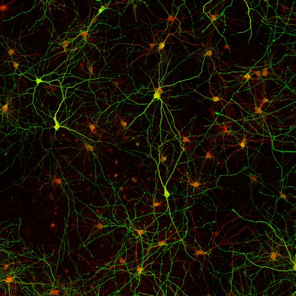 STAINperfect immunostaining kit A using with rabbit anti-GABA antibody permit direct detection of GABA (green) combined with detection of MAP2 (red, a neuron-specific cytoskeletal proteins) in primary cortical neurones.