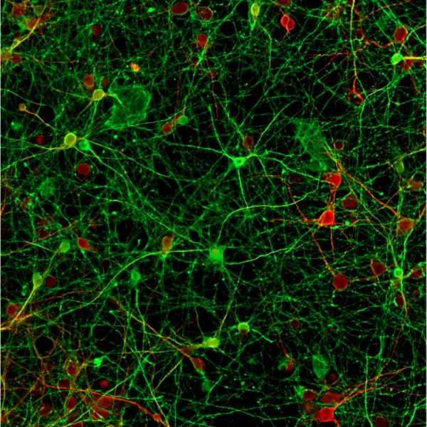 Image field micrographs of mature (12 DIV-old) rat cortical cultures, illustrating total and GABAergic neuronal networks revealed by MAP2 (in red) and GABA (in green) immunostaining, respectively. GABA immunostaining obtained using whether our monoclonal (#IS039) or polyclonal GABA antibody (#IS1006) with the STAINperfect immunostaining kit A is similar thereby underlining GABAergic cell bodies and dense punctiform GABAergic neurites.