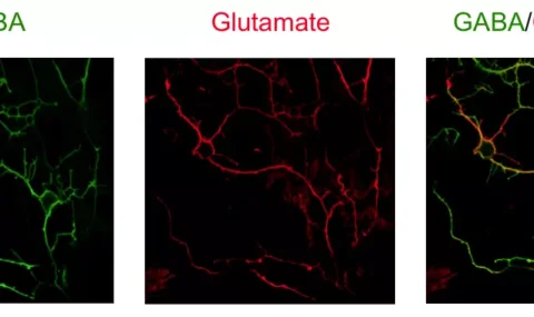 Neurotransmitter imaging: Differential organization of two key neurotransmitters within neurons revealed by STAINperfect kit