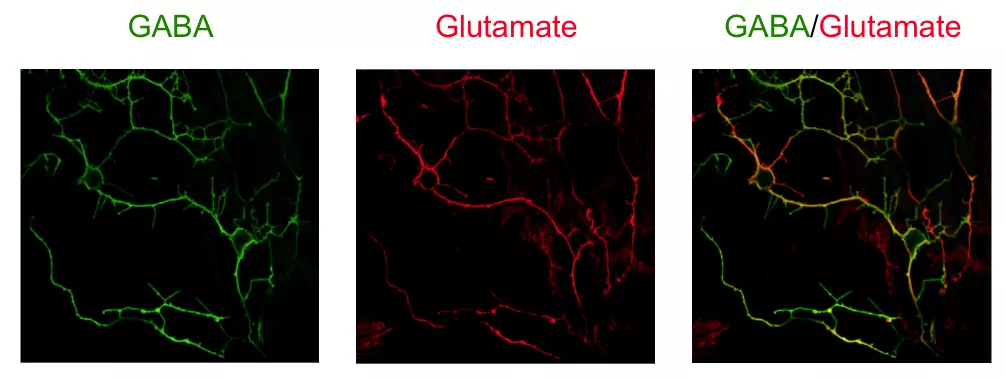 Neurotransmitter imaging: Differential organization of two key neurotransmitters within neurons revealed by STAINperfect kit