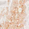 Immunohistochemical analysis reveals accumulation of L-Kynurenine within tumor cells of human colorectal cancer (CRC) tissue.