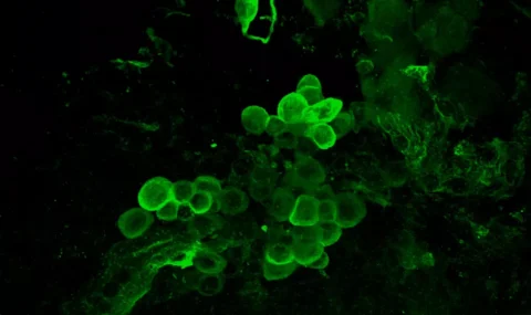 PICTURE OF THE WEEK: L-Glutamate in crayfish brain