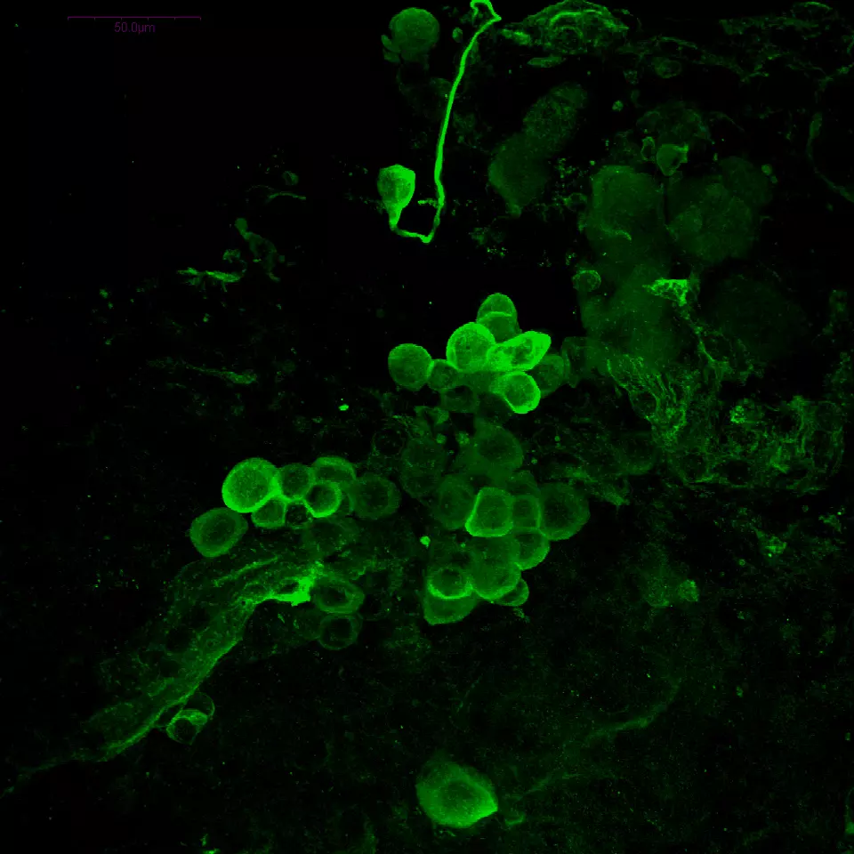 PICTURE OF THE WEEK: L-Glutamate in crayfish brain