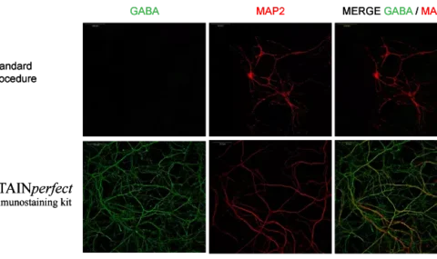 Neurotransmitter imaging protocols: Standard procedure versus STAINperfect immunostaining kit