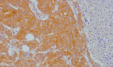 Polyclonal antibodies to Tryptophan / Kynurenine metabolites now available