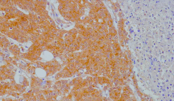 Polyclonal antibodies to Tryptophan / Kynurenine metabolites now available