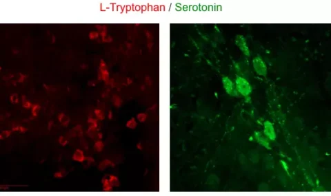 Challenge Serotonin and its precursor L-Tryptophan using STAINperfect immunostaining kit