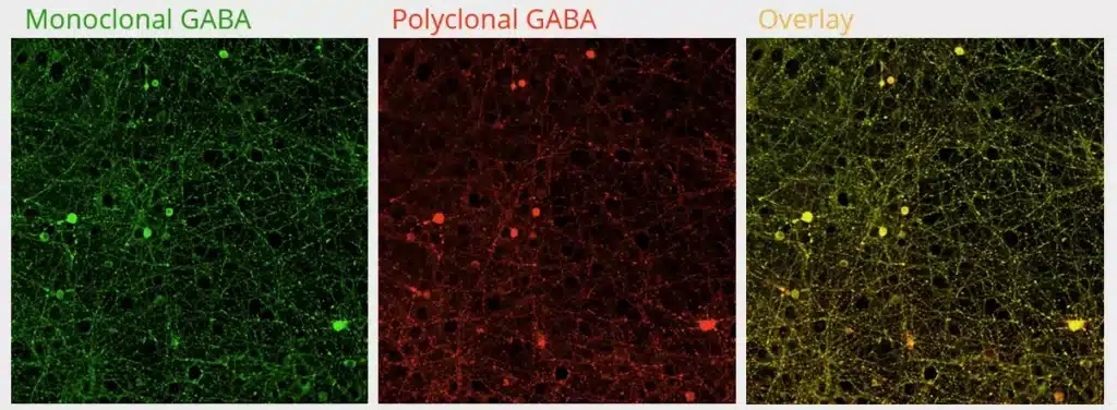 Antibodies to neurotransmitters as tools to evaluate the transmission network/function by immunofluorescence