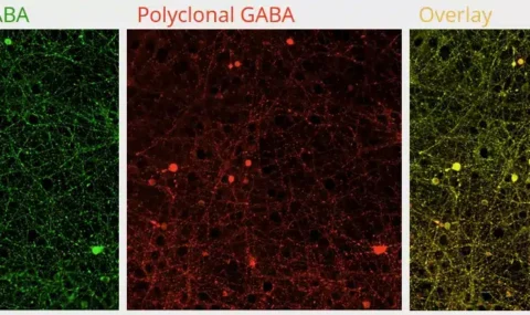 Antibodies to neurotransmitters as tools to evaluate the transmission network/function by immunofluorescence