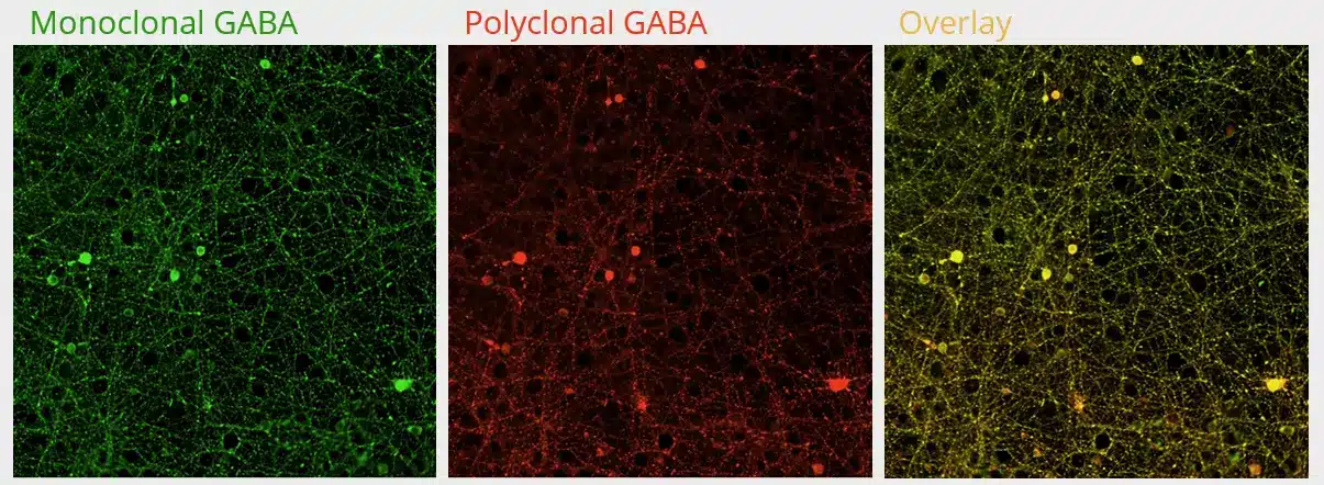 Antibodies to neurotransmitters as tools to evaluate the transmission network/function by immunofluorescence