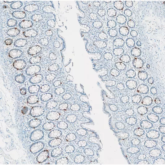 Immunohistochemistry against serotonin (5HT) on a FFPE human colon coronal section.
