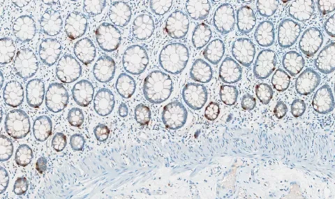 Immunohistochemistry against serotonin (5HT) on a FFPE human colon coronal section.