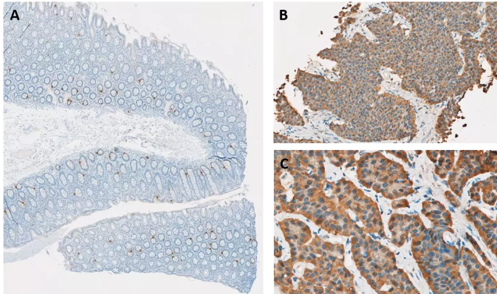 Reveal serotonin in your samples using our dedicated tools Immunohistochemistry against serotonin (5HT) on FFPE human tissues.
