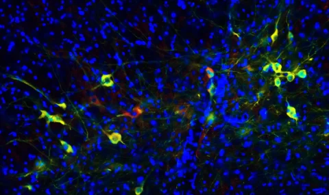 Dopamine TH staining antibody elisa organoids Parkinson's disease modeling