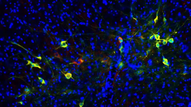 Dopamine TH staining antibody elisa organoids Parkinson's disease modeling