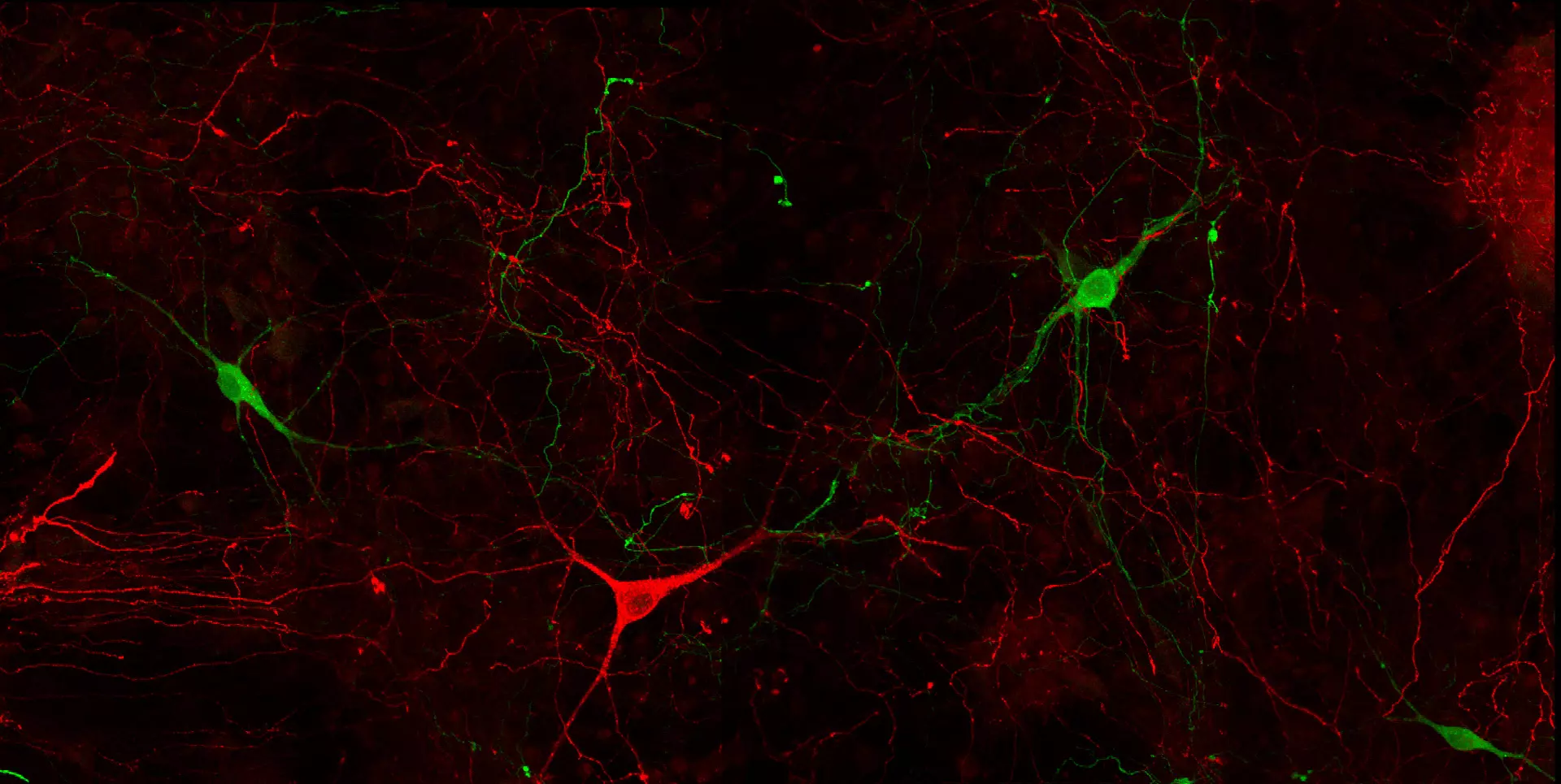 Dopamine (green) & Serotonin (red) in mouse primary neuronal culture using STAINperfect immunostaining kit with IS1005 (DA pAb) and IS1035 (5-HT pAb)