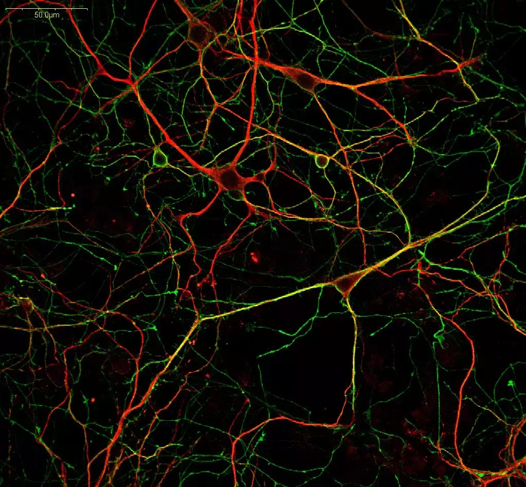 GABA (green) & MAP2 (red) in adult mouse primary cortical neurons