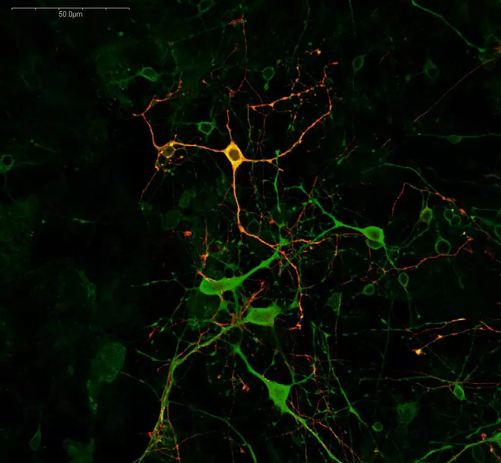L-Serine (green) & GABA (red) in primary cortical neurons (mouse)
