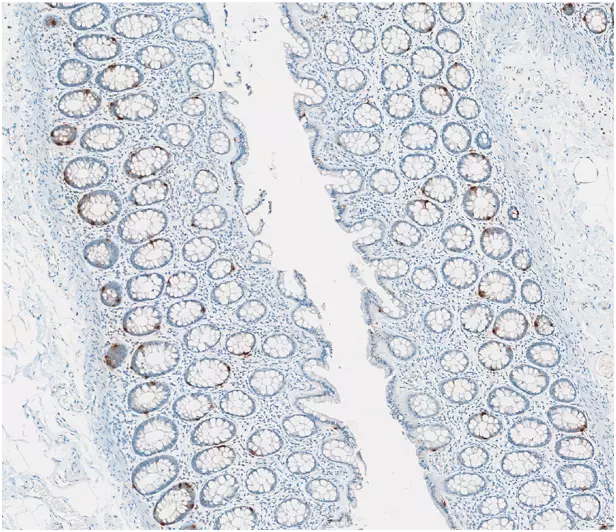 Serotonin in FFPE human colon tissue section (IHC)