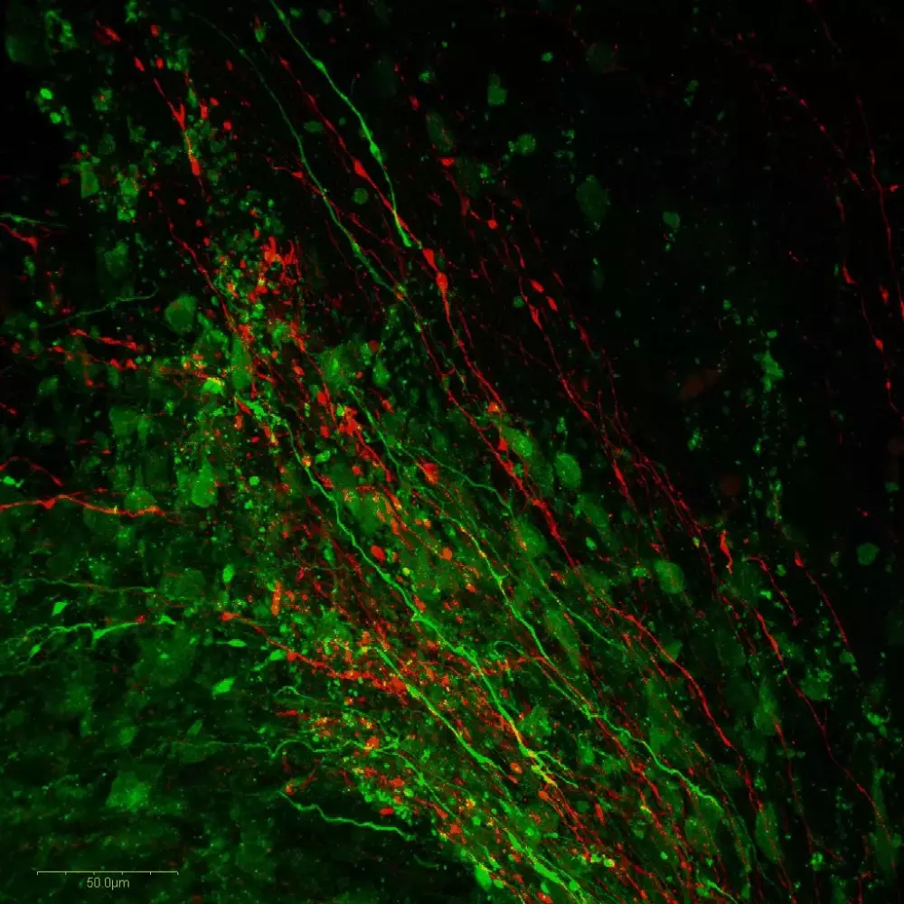 Dopamine (green) & Serotonin (red) in embryonic mouse brain (whole mount)