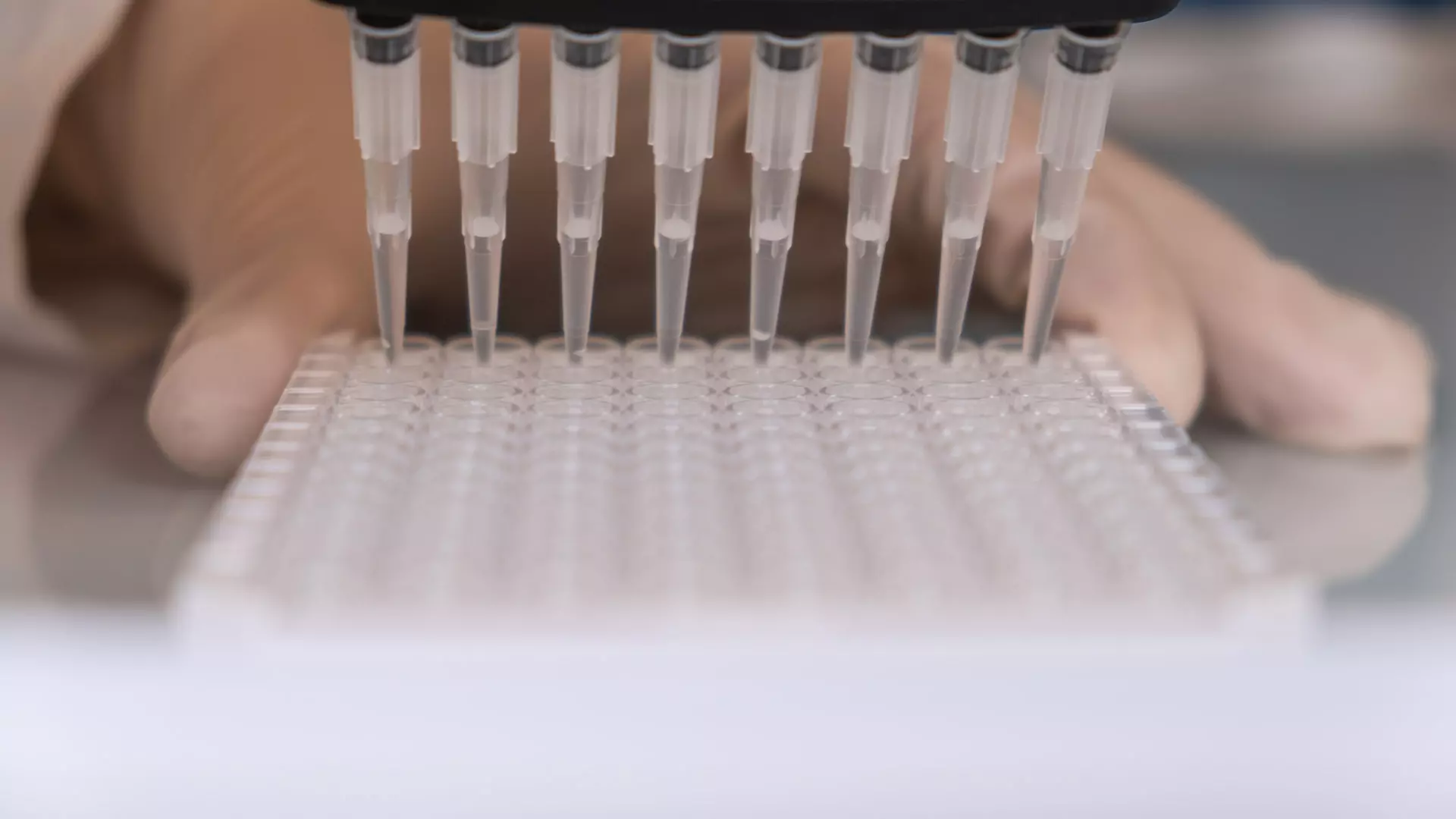 citrulline ELISA kit immusmol plasma