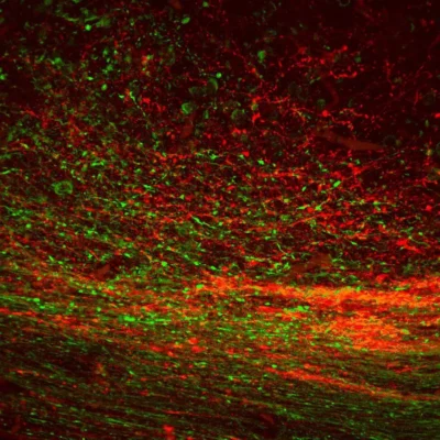 Serotonin / Tyrosine Hydroxylase in mouse embryonic midbrain