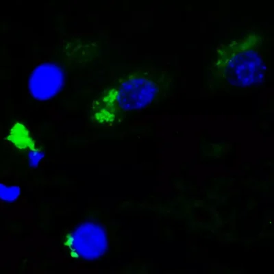 Xanthurenic acid detection by IF in human midbrain