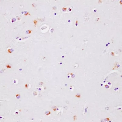 Kynurenic acid detection in human caudate putamen by IHC