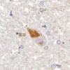 Quinaldic acid detection by IHC in human brain