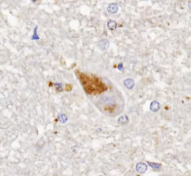 Quinaldic acid detection by IHC in human brain