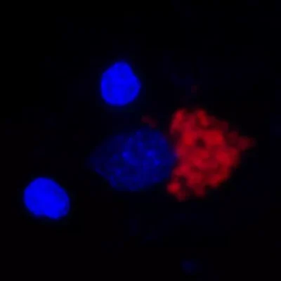 Quinolinic acid detection in human midbrain by immunohistofluorescence (IHF)