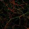 GABA antibody labeling (green) in mouse cortical primary neurons