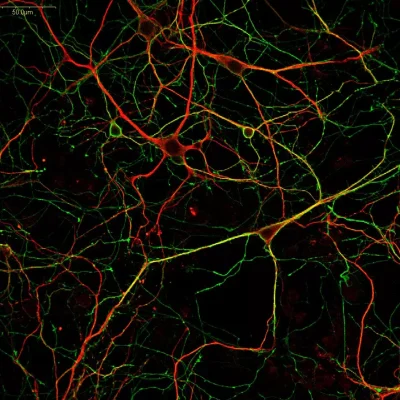 GABA antibody labeling (green) in mouse cortical primary neurons